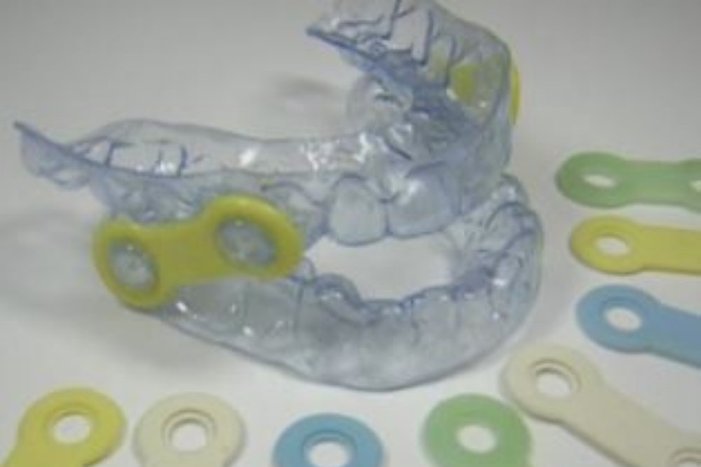 EMA Oral SleepBetter Appliance PROCraft Dental Lab